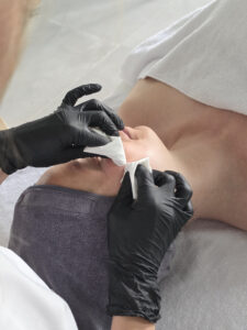 Huidtherapeut acne uitreinigen uit bij cliënt